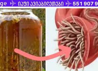 ეს საშუალება კურნავს ორგანიზმში არსებულ ნებისმიერ ინფექციას და კლავს ყველა პარაზიტს! ძველი, უნიკალური რეცეპტი!