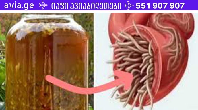 ეს საშუალება კურნავს ორგანიზმში არსებულ ნებისმიერ ინფექციას და კლავს ყველა პარაზიტს! ძველი, უნიკალური რეცეპტი!
