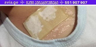 ჯანჯაფილის-თაფლის კომპრესი – კურნავს ძლიერ ხველას და აშორებს ლორწოს ფილტვებიდან მხოლოდ ერთ ღამეში!