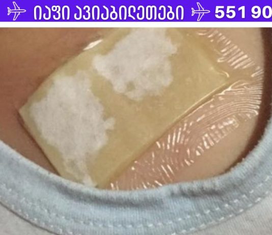 ჯანჯაფილის-თაფლის კომპრესი – კურნავს ძლიერ ხველას და აშორებს ლორწოს ფილტვებიდან მხოლოდ ერთ ღამეში!