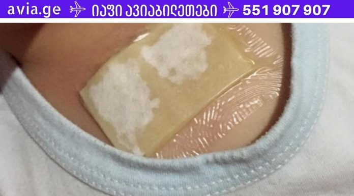 ჯანჯაფილის-თაფლის კომპრესი – კურნავს ძლიერ ხველას და აშორებს ლორწოს ფილტვებიდან მხოლოდ ერთ ღამეში!