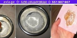 ამ კომპრესს ბავშვობიდან ვაკეთებ. კურნავს ყველაზე უარეს ხველას ერთ ღამეში!