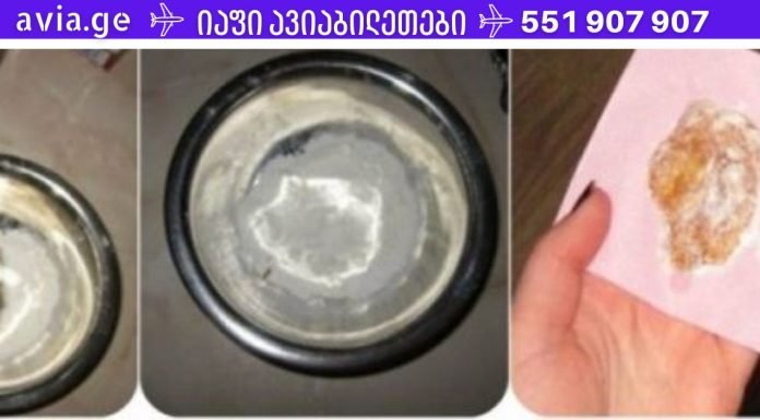 ამ კომპრესს ბავშვობიდან ვაკეთებ. კურნავს ყველაზე უარეს ხველას ერთ ღამეში!