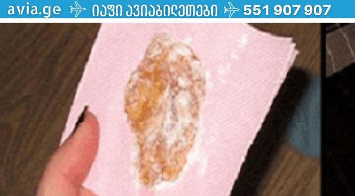 გაასუფთავეთ ფილტვები ლორწოსგან და მოიშორეთ ცუდი ხველა 1 ღამეში!