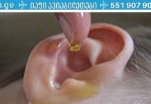 ამის 2 წვეთი ყურებში და სმენის 97% აღდგება! ის ეხმარება მოხუცებსაც კი!