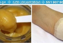 აი, როგორ გახადოთ თქვენი ქუსლები კატის თათებივით რბილი: სიმშრალე და ბზარები წარსულს ჩაბარდა!