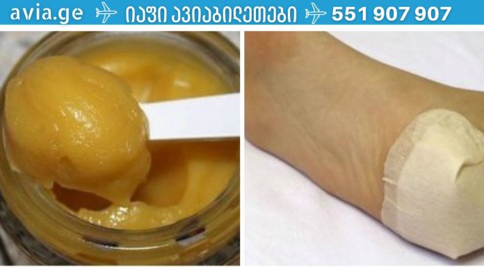 აი, როგორ გახადოთ თქვენი ქუსლები კატის თათებივით რბილი: სიმშრალე და ბზარები წარსულს ჩაბარდა!