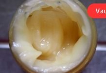 ამ ქალს უთხრეს რომ მისი გული ვერ გადარჩებოდა,თუ არ შეამცირებდა ქოლესტერინის დონეს,ნახეთ რა მოხდა.