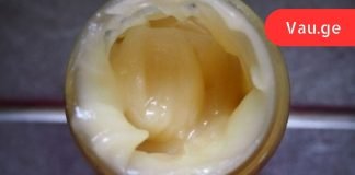 ამ ქალს უთხრეს რომ მისი გული ვერ გადარჩებოდა,თუ არ შეამცირებდა ქოლესტერინის დონეს,ნახეთ რა მოხდა.