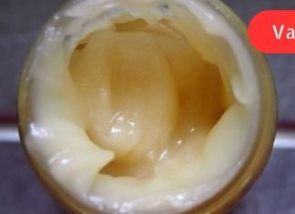 ამ ქალს უთხრეს რომ მისი გული ვერ გადარჩებოდა,თუ არ შეამცირებდა ქოლესტერინის დონეს,ნახეთ რა მოხდა.