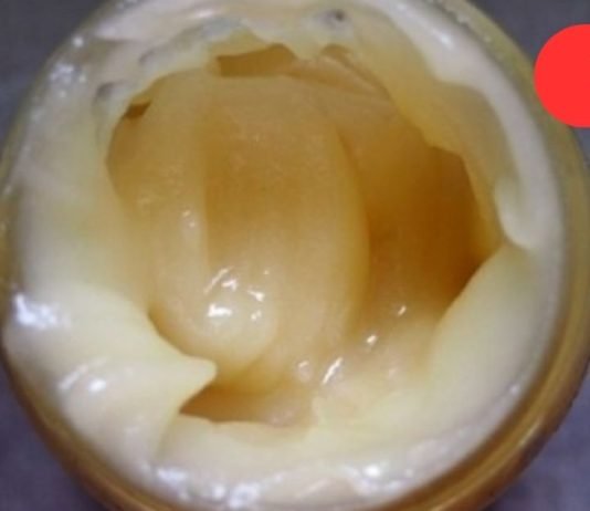 ამ ქალს უთხრეს რომ მისი გული ვერ გადარჩებოდა,თუ არ შეამცირებდა ქოლესტერინის დონეს,ნახეთ რა მოხდა.