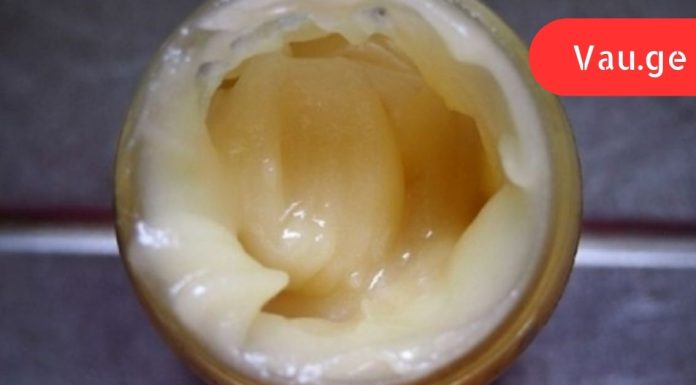 ამ ქალს უთხრეს რომ მისი გული ვერ გადარჩებოდა,თუ არ შეამცირებდა ქოლესტერინის დონეს,ნახეთ რა მოხდა.