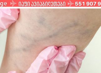 ხელნაკეთი მალამო ვარიკოზული ვენებისთვის, რომელმაც დედაჩემი გადაარჩინა ოპერაციისგან