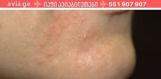 ხალხური საშუალებები, რომელებიც დაგეხმარებათ დერმატიტის განკურნებაში