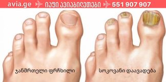 ფრჩხილის სოკოს 3 ხალხური საშუალება