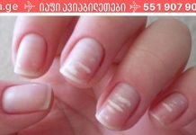 ფრთხილად იყავით.რატომ უჩნდება ზოგს თეთრი ლაქები ფრჩხილებზე?