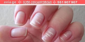 ფრთხილად იყავით.რატომ უჩნდება ზოგს თეთრი ლაქები ფრჩხილებზე?