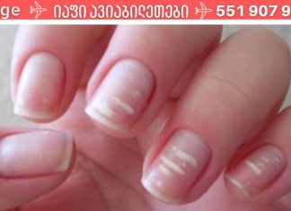 ფრთხილად იყავით.რატომ უჩნდება ზოგს თეთრი ლაქები ფრჩხილებზე?