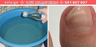 ჩემმა მეგობარმა უმარტივესად იმკურნალა სახლში ფრჩხილის სოკოზე.ეს სასწაულებრივი ნაზავი ერთხელ და სამუდამოდ აქრობს ფრჩხილის სოკოს.