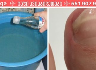 ჩემმა მეგობარმა უმარტივესად იმკურნალა სახლში ფრჩხილის სოკოზე.ეს სასწაულებრივი ნაზავი ერთხელ და სამუდამოდ აქრობს ფრჩხილის სოკოს.