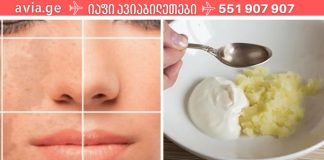 მეგობარმა ქორწილამდე 3 დღით ადრე სახის მალამო გააკეთა და ის სახე ანათებდა ,ნებისმიერ ასაკში სასწაულებს ახდენს