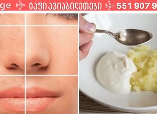 მეგობარმა ქორწილამდე 3 დღით ადრე სახის მალამო გააკეთა და ის სახე ანათებდა ,ნებისმიერ ასაკში სასწაულებს ახდენს