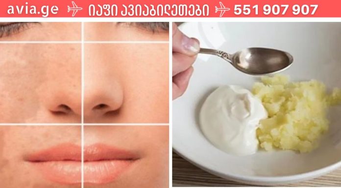 მეგობარმა ქორწილამდე 3 დღით ადრე სახის მალამო გააკეთა და ის სახე ანათებდა ,ნებისმიერ ასაკში სასწაულებს ახდენს