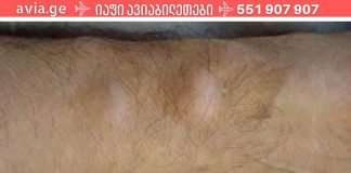 როგორ მოვიშოროთ ცხიმოვანი ქსოვილი (ლიპომა) ერთი ხალხური საშუალებით!?