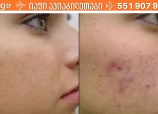 აკნეს ( პროჩიკების ) ყველაზე ეფექტური საშუალება!