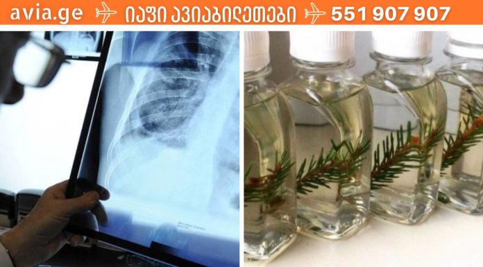 ნაძვის ზეთიც თუ არსებობდა არ მეგონა,მეზობელმა მასწავლა მისი გამოყენება უამრავი დაავადების დროს.