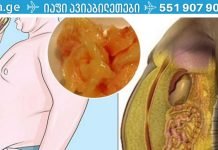 როგორ შევამციროთ მადა:რეკომენდაციები მათთვის, ვისაც წონის დაკლება სურს