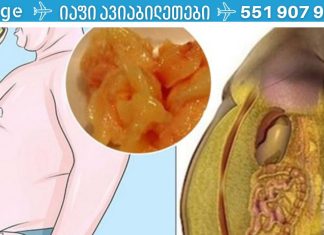 როგორ შევამციროთ მადა:რეკომენდაციები მათთვის, ვისაც წონის დაკლება სურს