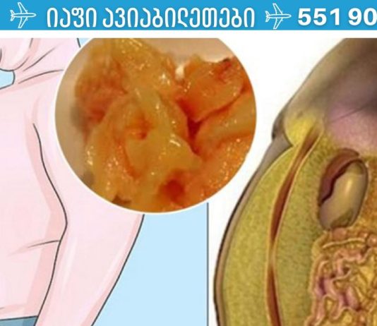 როგორ შევამციროთ მადა:რეკომენდაციები მათთვის, ვისაც წონის დაკლება სურს