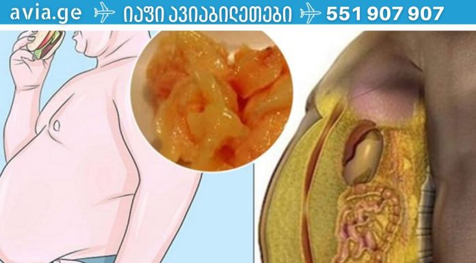 როგორ შევამციროთ მადა:რეკომენდაციები მათთვის, ვისაც წონის დაკლება სურს