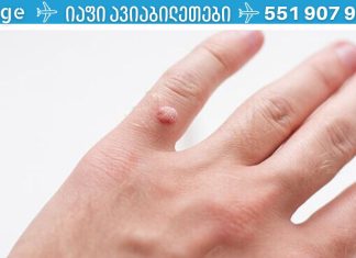 მეჭეჭებისგან თავის დაღწევის საუკეთესო გზები