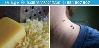 ნახეთ,როგორ მოვიშოროთ მეჭეჭები სარეცხი საპონით.