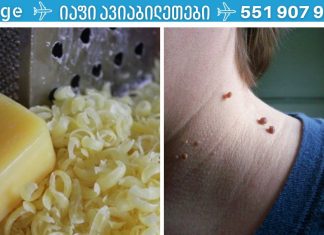 ნახეთ,როგორ მოვიშოროთ მეჭეჭები სარეცხი საპონით.