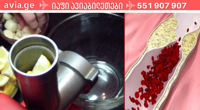 დადასტურებული რეცეპტი! მხოლოდ 1 კოვზი უზმოზე და თქვენი სისხლძარღვები გასუფთავდება.