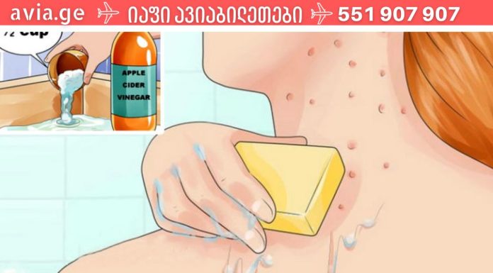 ვაშლის სიდრი ძმრის სარგებელი კანისთვის