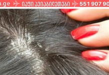 ამას აქამდე არავინ გასწავლიდათ.როგორ მოვიშოროთ ქერტლი სახლის საშუალებებით