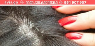 ამას აქამდე არავინ გასწავლიდათ.როგორ მოვიშოროთ ქერტლი სახლის საშუალებებით