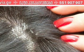 ამას აქამდე არავინ გასწავლიდათ.როგორ მოვიშოროთ ქერტლი სახლის საშუალებებით