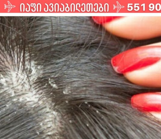 ამას აქამდე არავინ გასწავლიდათ.როგორ მოვიშოროთ ქერტლი სახლის საშუალებებით