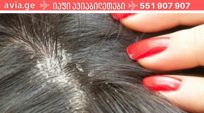 ამას აქამდე არავინ გასწავლიდათ.როგორ მოვიშოროთ ქერტლი სახლის საშუალებებით