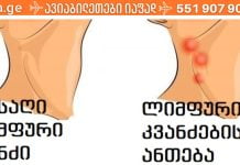 ლიმფური კვანძები და რა უნდა იცოდეთ მათზე