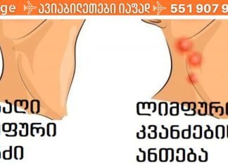 ლიმფური კვანძები და რა უნდა იცოდეთ მათზე