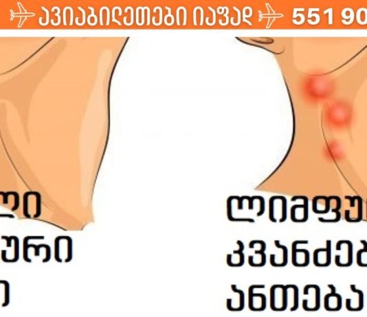 ლიმფური კვანძები და რა უნდა იცოდეთ მათზე