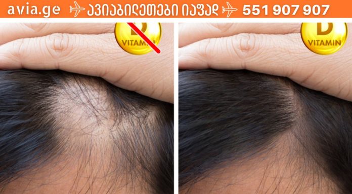 რას იწვევს D ვიტამინის ნაკლებობა.