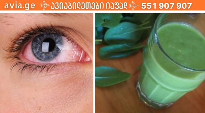 ეს საკვები დაგეხმარებათ მხედველობის შენარჩუნებაში წლების განმავლობაში!