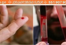 სისხლის სისქის – სიმბლანტის შესამცირებელი მეთოდები.